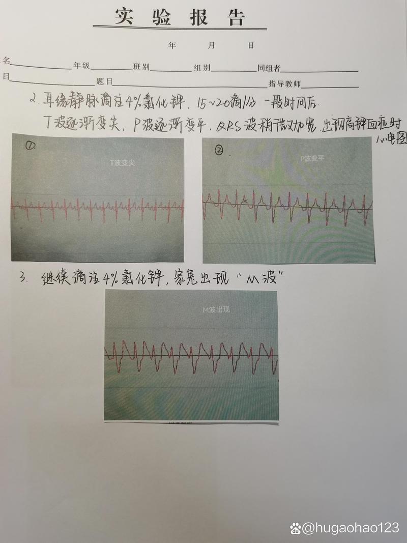 给大家普及下病理生理学试题及答案学习教程免费下载病理生理学试题及答案题库及答案